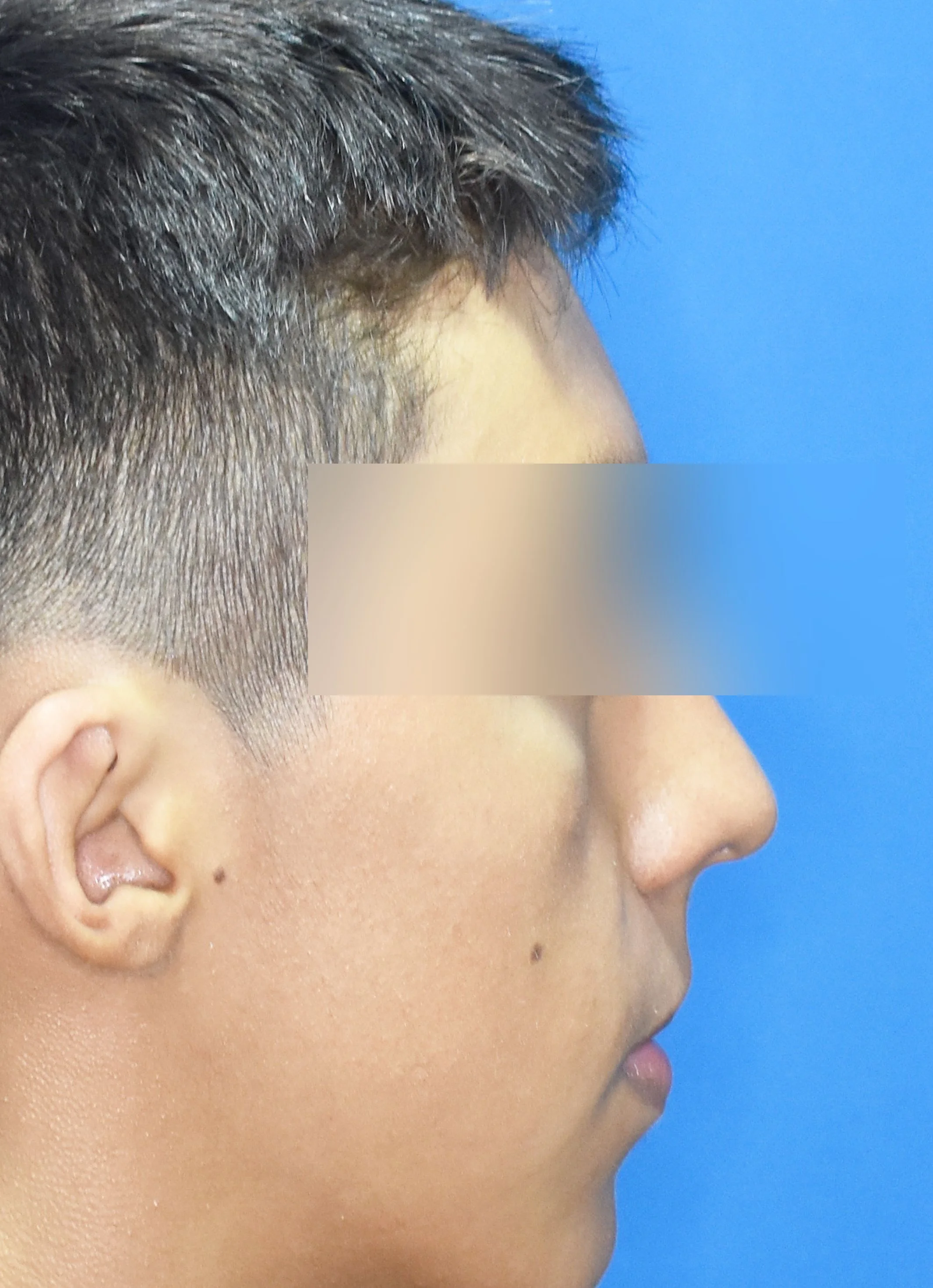 Después, Perfil · Paciente I (con consentimiento; identidad anonimizada)